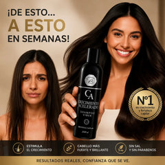 CHAMPÚ Crecimiento Acelerado 2 - NaroStore