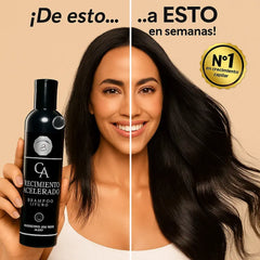 🍃 CHAMPÚ Crecimiento Acelerado