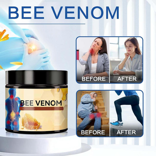 Bee venom cream for joint and bone relief
